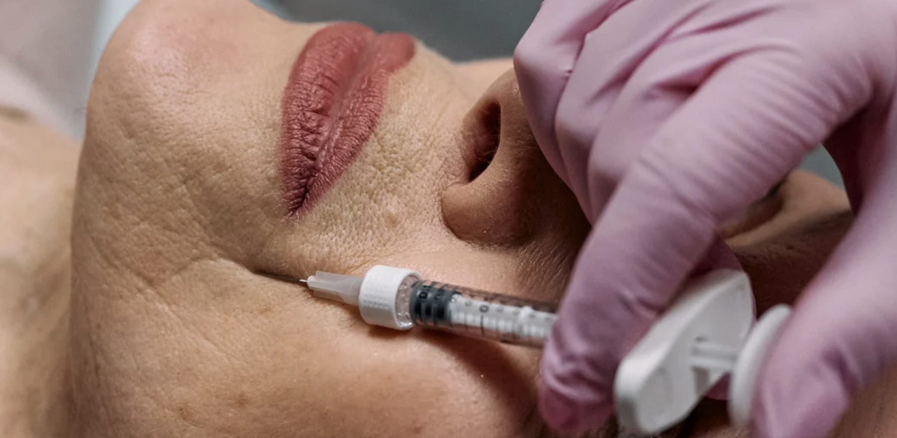 Botox Pricing per Unit and Best Results in Northern Virginia